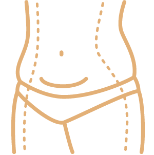 Tummy Tuck