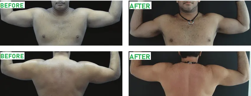 Arm contouring male-1