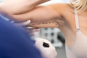 Arm contouring female