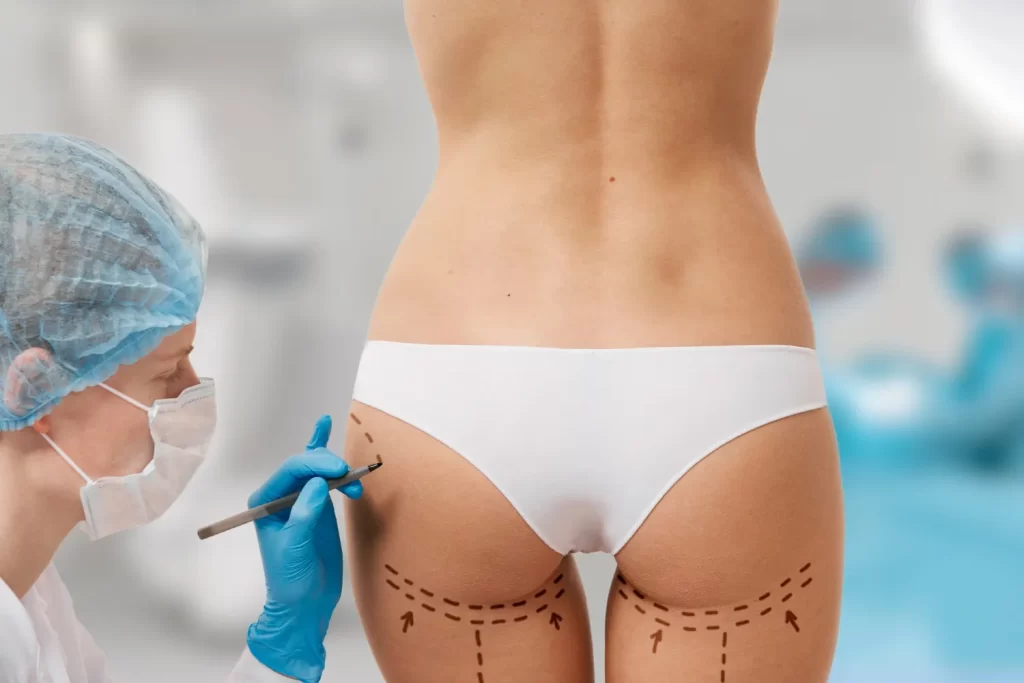 Buttock enhancement female