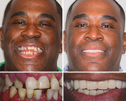 Cosmetic dental solutions male 5