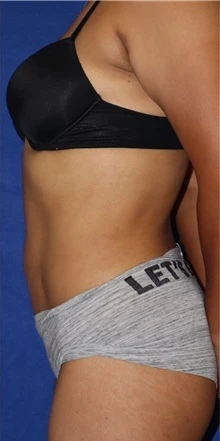 Customized body reshaping female 2