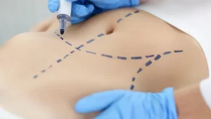 Customized body reshaping female