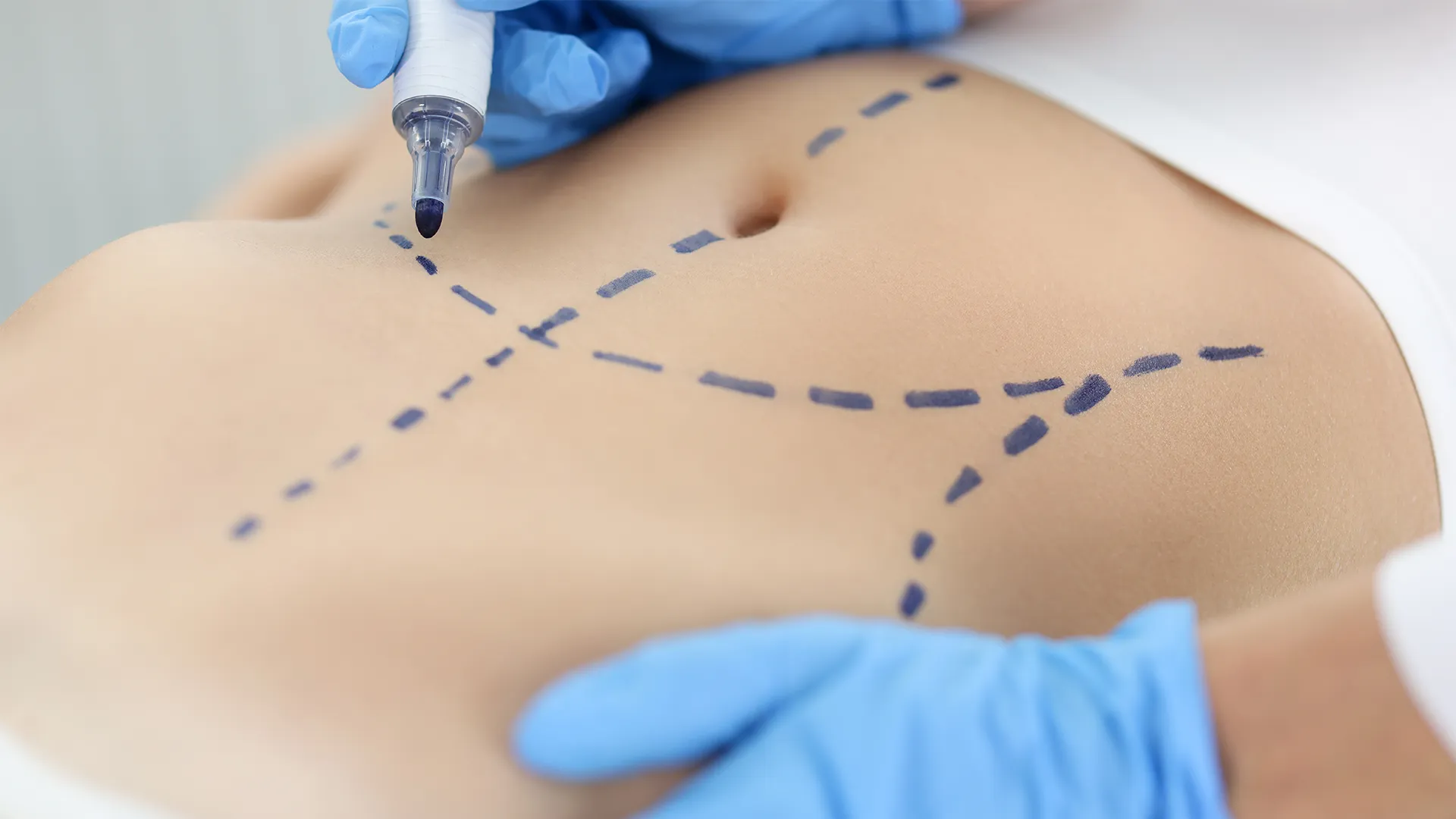 Customized body reshaping female