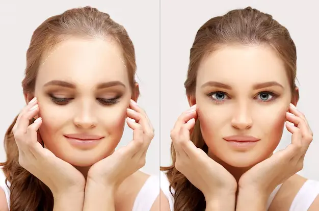 hair restoration female 2