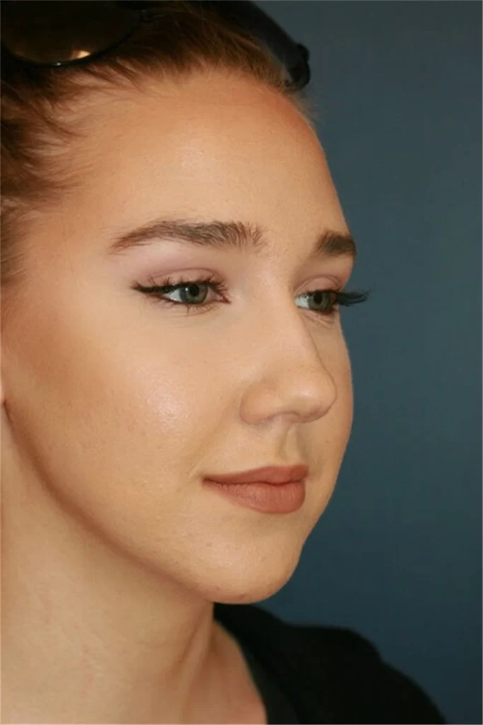 nose reshaping contouring female 4