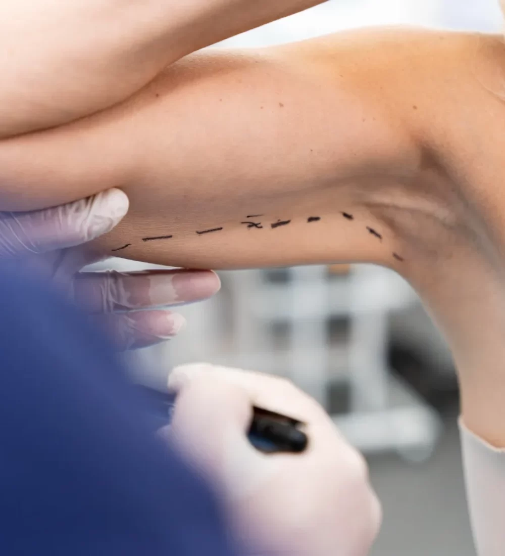 Woman showing Arm contouring