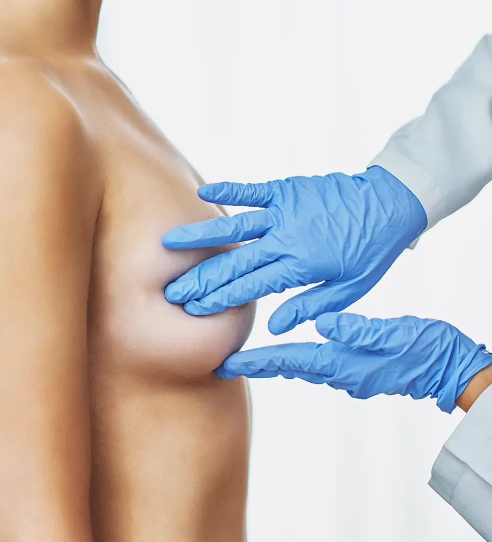 Breast reduction female cover