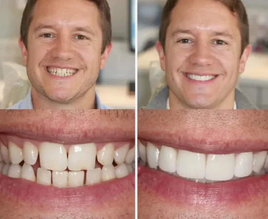 Cosmetic dental solutions male 2